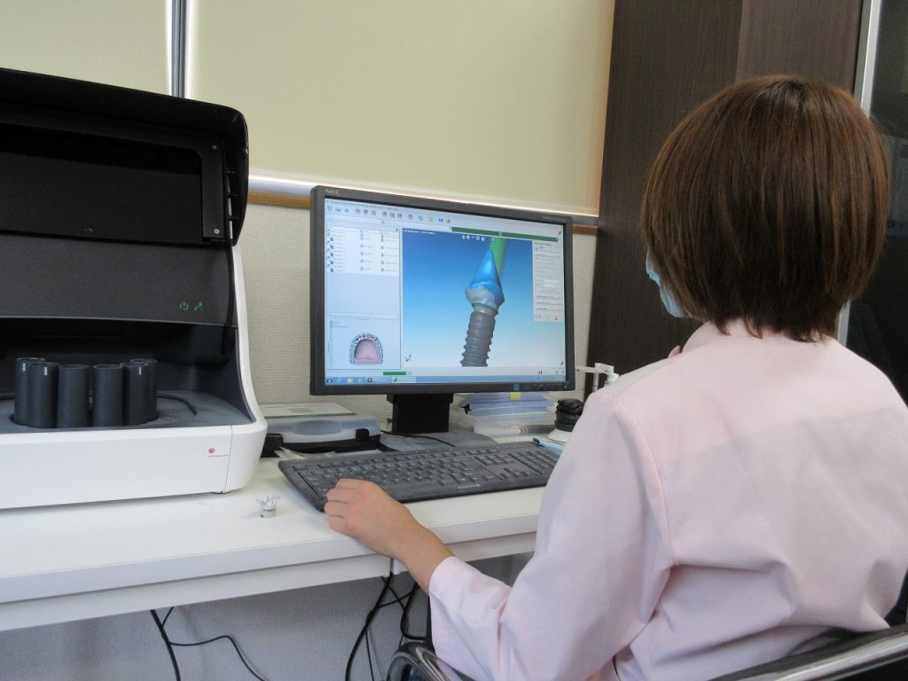 sTRAUMAN＠CARESSCAN　CS2　歯科用の高精度3Dスキャナー