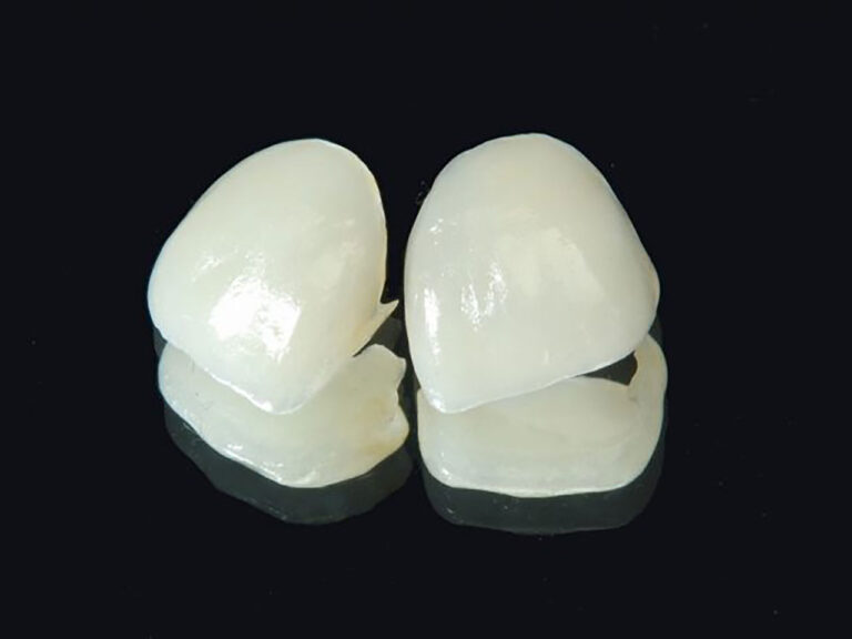 e-max 01