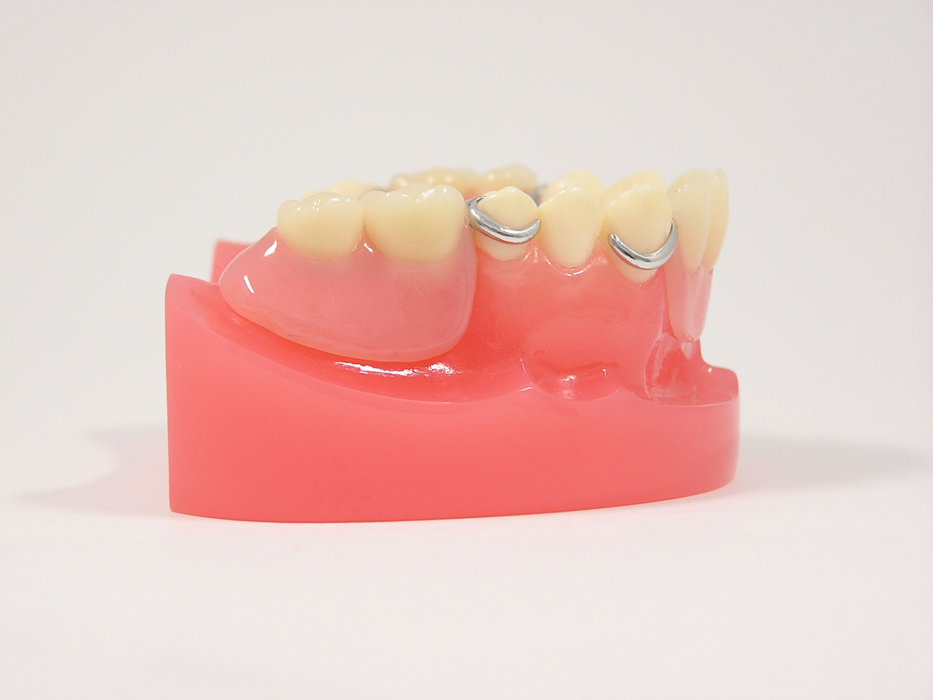 h_denture03
